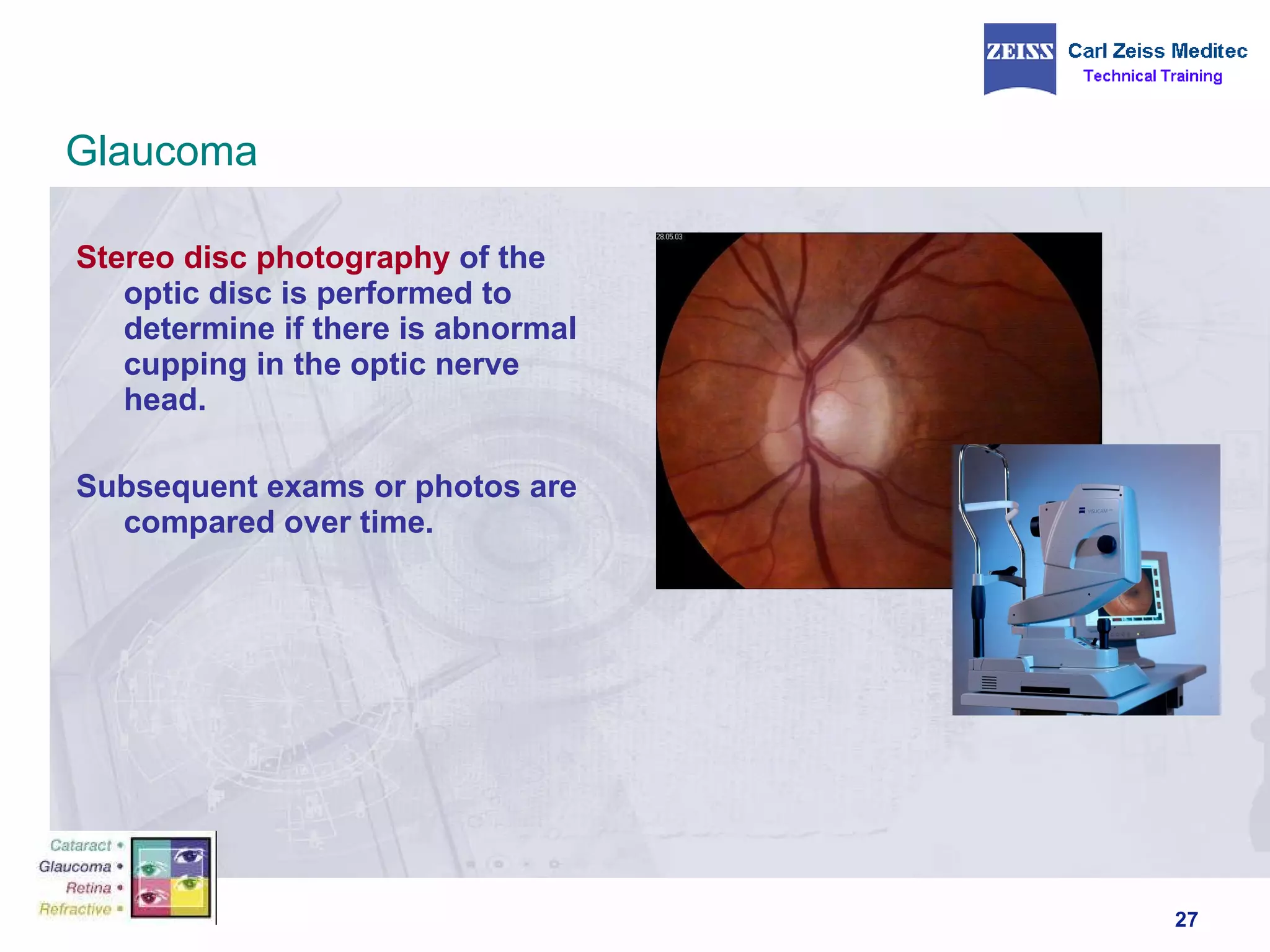 Stereo disc photography  of the optic disc is performed to determine if there is abnormal cupping in the optic nerve head. Subsequent exams or photos are compared over time. Glaucoma 
