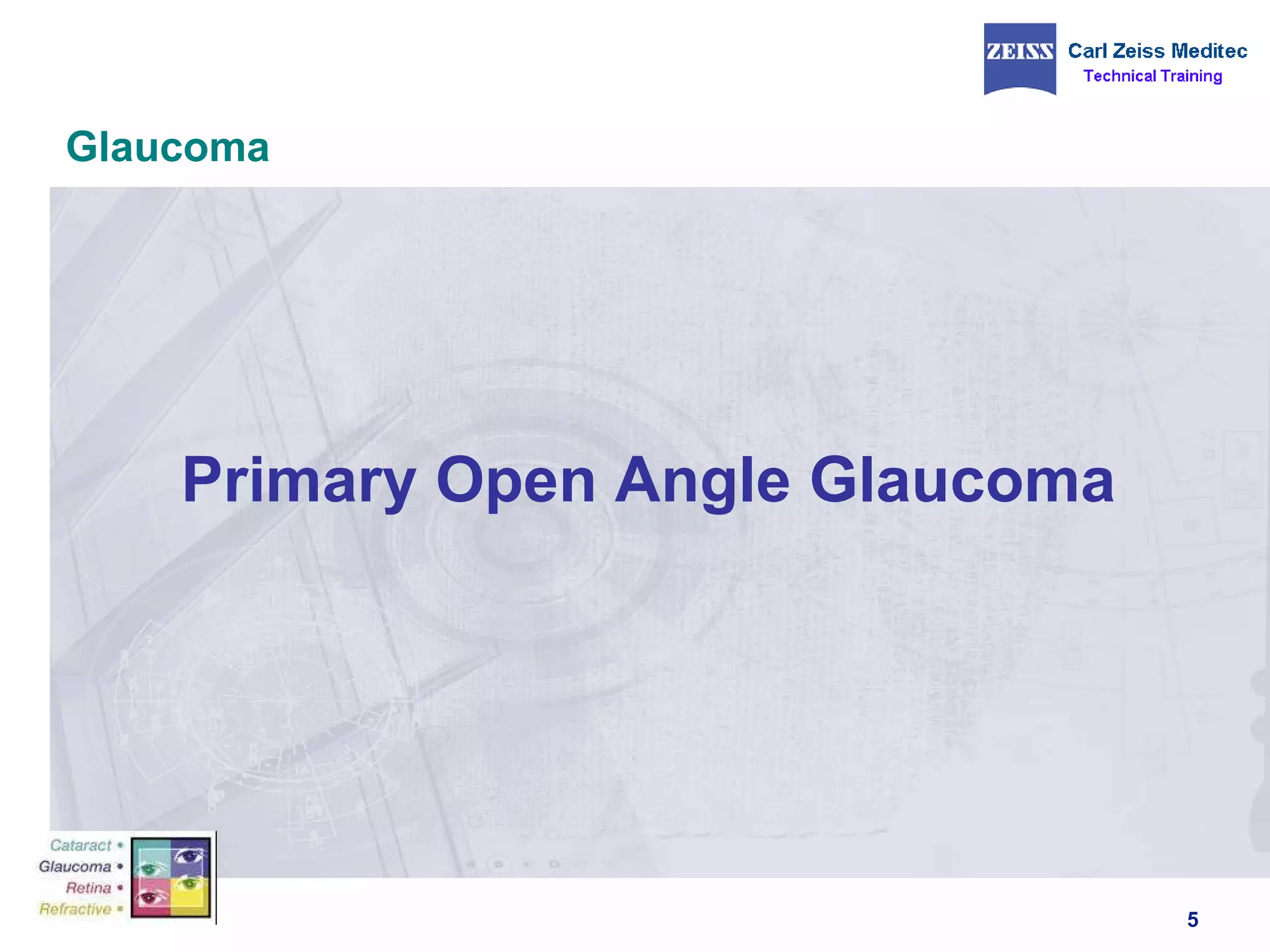 Glaucoma Primary Open Angle Glaucoma 
