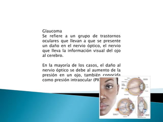 Glaucoma
Se refiere a un grupo de trastornos
oculares que llevan a que se presente
un daño en el nervio óptico, el nervio
que lleva la información visual del ojo
al cerebro.

En la mayoría de los casos, el daño al
nervio óptico se debe al aumento de la
presión en un ojo, también conocida
como presión intraocular (PIO).
 