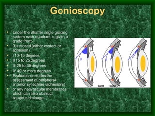 Gonioscopy Under the Shaffer angle grading system each quadrant is given a grade from:- 0 is closed (either contact or adhesion) I 10-15 degrees II 15 to 25 degrees III 25 to 35 degrees IV 40 or more degrees Evaluation includes the assessment of peripheral anterior synechiae (adhesions)  or any neovascular membranes which can also obstruct aqueous drainage.  