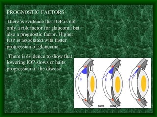 PROGNOSTIC FACTORS  There is evidence that IOP is not only a risk factor for glaucoma but also a prognostic factor. Higher IOP is associated with faster progression of glaucoma. There is evidence to show that lowering IOP slows or halts progression of the disease  