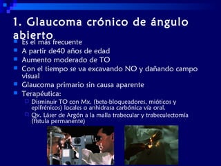 1. Glaucoma crónico de ángulo
abierto







Es el más frecuente
A partir de40 años de edad
Aumento moderado de TO
Con el tiempo se va excavando NO y dañando campo
visual
Glaucoma primario sin causa aparente
Terapéutica:



Disminuir TO con Mx. (beta-bloqueadores, mióticos y
epifrénicos) locales o anhidrasa carbónica vía oral.
Qx. Láser de Argón a la malla trabecular y trabeculectomía
(fístula permanente)

 