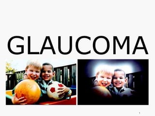 GLAUCOMA
1
 