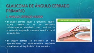 Glaucoma | PPTX