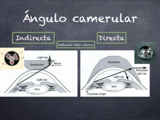 Ángulo camerular
Reflexión total interna
Indirecta Directa
 