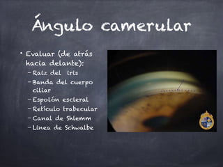 Ángulo camerular
• Evaluar (de atrás
hacia delante):
– Raiz del iris
– Banda del cuerpo
ciliar
– Espolón escleral
– Retículo trabecular
– Canal de Shlemm
– Linea de Schwalbe
 