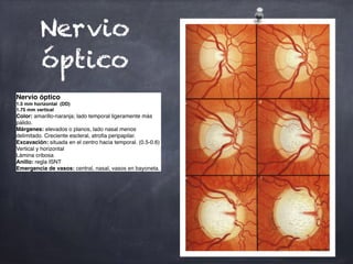 Nervio
óptico
Nervio óptico
1.5 mm horizontal (DD)
1.75 mm vertical
Color: amarillo-naranja; lado temporal ligeramente más
pálido.
Márgenes: elevados o planos, lado nasal menos
delimitado. Creciente escleral, atrofia peripapilar.
Excavación: situada en el centro hacia temporal. (0.5-0.6)
Vertical y horizontal
Lámina cribosa
Anillo: regla ISNT
Emergencia de vasos: central, nasal, vasos en bayoneta.
 