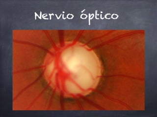 Nervio óptico
 