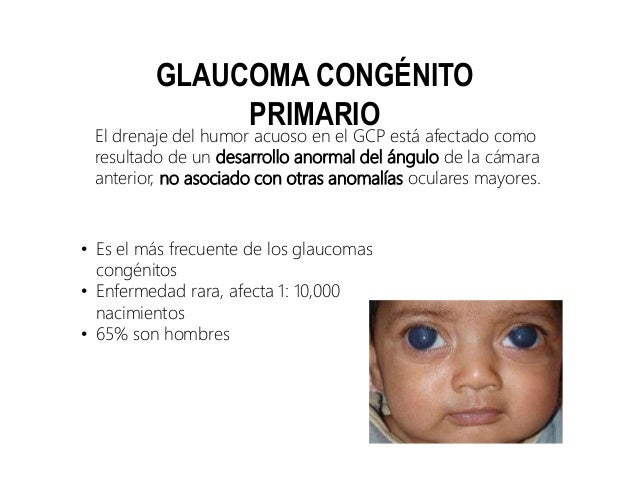 GLAUCOMA clasificación y fisiopatología