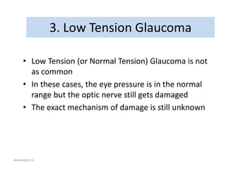 www.opto.ca
3. Low Tension Glaucoma
• Low Tension (or Normal Tension) Glaucoma is not
as common
• In these cases, the eye pressure is in the normal
range but the optic nerve still gets damaged
• The exact mechanism of damage is still unknown
 