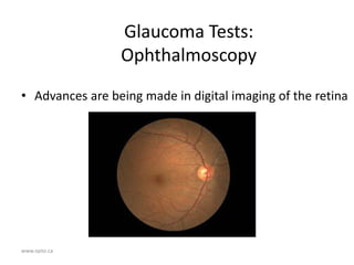 www.opto.ca
Glaucoma Tests:
Ophthalmoscopy
• Advances are being made in digital imaging of the retina
 