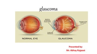 glaucoma
Presented by:
Mr. Abhay Rajpoot
 