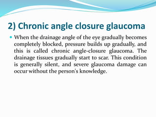 2) Chronic angle closure glaucoma
 When the drainage angle of the eye gradually becomes
completely blocked, pressure builds up gradually, and
this is called chronic angle-closure glaucoma. The
drainage tissues gradually start to scar. This condition
is generally silent, and severe glaucoma damage can
occur without the person's knowledge.
 