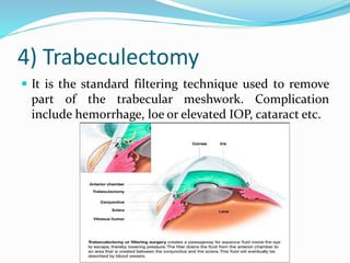 4) Trabeculectomy
 It is the standard filtering technique used to remove
part of the trabecular meshwork. Complication
include hemorrhage, loe or elevated IOP, cataract etc.
 