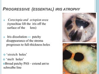 glaucoma-200919094045.pptx