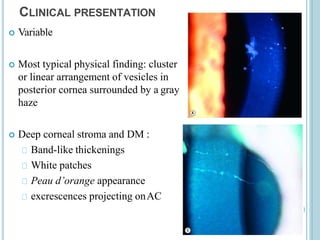 Linear Vesicles glaucoma-200919094045.pptx