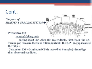 Diagram of
SHAFFER’S GRADING SYSTEM 
• Provocative test-
water drinking test-
fasting about 8hr. , then 1lit. Water drink , First check- the IOP
15 min. gap measure the value & Second check- the IOP 1hr. gap measure
the value .
(maximum IOP – Minimum IOP) is more than 8mm/hg(>8mm/hg)
then abnormal condition.
Cont.
 
