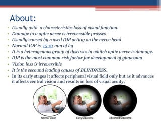 • Usually with a charecteristics loss of visual function.
• Damage to a optic nerve is irreversible prosses
• Usually caused by raised IOP acting on the nerve head
• Normal IOP is 15-21 mm of hg
• It is a heterogenous group of diseases in whitch optic nerve is damage.
• IOP is the most common risk factor for development of glaucoma
• Vision loss is irreversible
• It is the secound leading causes of BLINDNESS.
• In its early stages it affects peripheral visual field only but as it advances
it affects central vision and results in loss of visual acuity,
About:
 