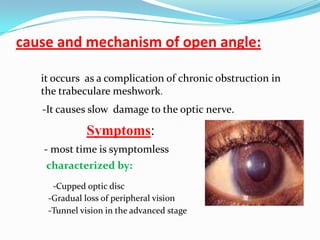 cause and mechanism of open angle:

   it occurs as a complication of chronic obstruction in
   the trabeculare meshwork.
   -It causes slow damage to the optic nerve.

             Symptoms:
   - most time is symptomless
    characterized by:
     -Cupped optic disc
    -Gradual loss of peripheral vision
    -Tunnel vision in the advanced stage
 