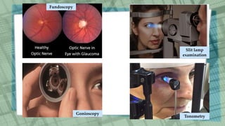 Slit lamp
examination
Fundoscopy
Tonometry
Gonioscopy
 