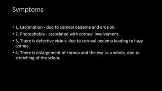 Symptoms
• 1. Lacrimation - due to corneal oedema and erosion.
• 2. Photophobia - associated with corneal involvement.
• 3. There is defective vision- due to corneal oedema leading to hazy
cornea.
• 4. There is enlargement of cornea and the eye as a whole, due to
stretching of the sclera.
 