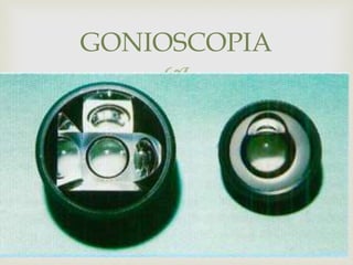 
 FOTO 9,19 9.15
GONIOSCOPIA
 