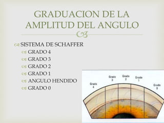 
 SISTEMA DE SCHAFFER
 GRADO 4
 GRADO 3
 GRADO 2
 GRADO 1
 ANGULO HENDIDO
 GRADO 0
GRADUACION DE LA
AMPLITUD DEL ANGULO
 