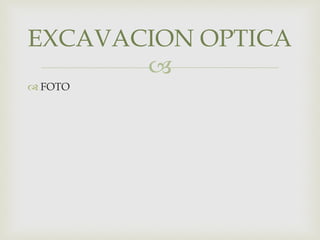 
 FOTO
EXCAVACION OPTICA
 