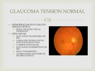 
 HEMORRAGIAS EN FLAMA EN
NERVIO OPTICO
 SEÑAL DE DAÑO VISUAL
INMINENTE
 DESCARTAR:
 ELEVACION TRANSITORIA DE
PIO
 VARIACION DIURNA DE PIO
ELEVACION MATUTINA
 CAMBIOS POSTURALES
 ELEVACION INTERMITENTE DE
PIO
 MALA TONOMETRIA
 ALTERACIONE ANATOMICAS
DE DISCO OPTICO
GLAUCOMA TENSION NORMAL
 