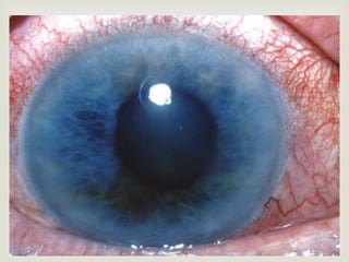 
 FOTO BLOQUEO
 