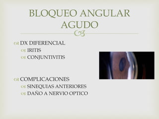 
 DX DIFERENCIAL
 IRITIS
 CONJUNTIVITIS
 COMPLICACIONES
 SINEQUIAS ANTERIORES
 DAÑO A NERVIO OPTICO
BLOQUEO ANGULAR
AGUDO
 
