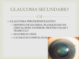 
 GLAUCOMA PSEUDOEXFOLIATIVO
 DEPOSITO DE MATERIAL BLANQUECINO EN
CRISTALOIDES ANTERIOR, PROCESO CILIAR Y
TRABECULO
 MAYORES 65 AÑOS
 CATARATAS COMPLICADAS
GLAUCOMA SECUNDARIO
 