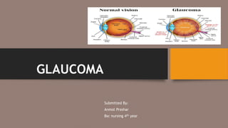 GLAUCOMA
Submitted By:
Anmol Prashar
Bsc nursing 4th year
 