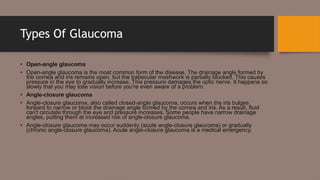 Glaucoma.pptx
