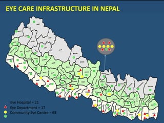Krishna Gopal Shrestha
Eye Hospital = 21
Eye Department = 17
Community Eye Centre = 63
EYE CARE INFRASTRUCTURE IN NEPAL
 