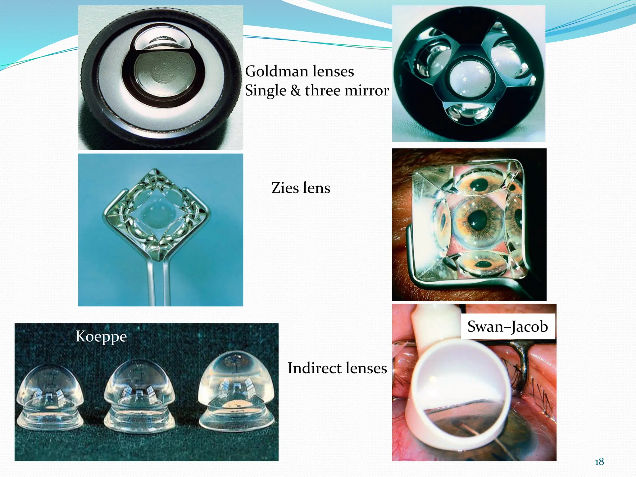 18
Goldman lenses
Single & three mirror
Zies lens
Koeppe
Swan–Jacob
Indirect lenses
 