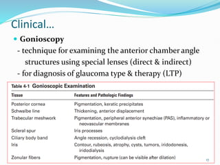 GLAUCOMA department of ophthalmology uog | PDF