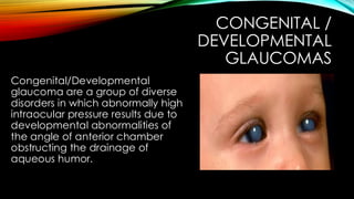 CONGENITAL /
DEVELOPMENTAL
GLAUCOMAS
Congenital/Developmental
glaucoma are a group of diverse
disorders in which abnormally high
intraocular pressure results due to
developmental abnormalities of
the angle of anterior chamber
obstructing the drainage of
aqueous humor.
 