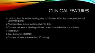 CLINICAL FEATURES
➢Lacrimation- Excessive tearing due to irritation, infection, or obstruction of
Lacrimal gland
➢Photophobia- Abnormal sensitivity to light
➢Corneal oedema- Swelling of the cornea due to fluid accumulation
➢Raised IOP
➢Eyes become MYOPIC
➢Corneal diameter more than 13 mmhg
 