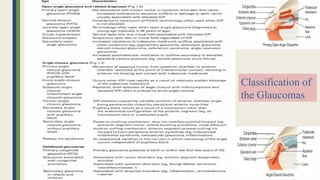 Classification of
the Glaucomas
 
