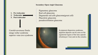 1. Pre trabecular
2. Trabecular
3. Post trabecular
Pigmentery glaucoma
Real cell glaucoma
Degenerate red cells glaucoma(goust cell)
Phacolytic glaucoma
pseudoexfoliation glaucoma
Carotid-cavernous fistula
sturge weber syndrome
superior vena cava syndrome
In pigment dispersion syndrome,
pigment deposits can be seen on the
equatorial region of the lens capsule
(Zentmayer l ine) and on the zonules.
Secondary Open-Angle Glaucoma
 
