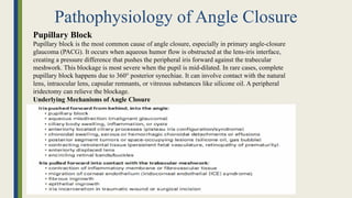 Pathophysiology of Angle Closure
Pupillary Block
Pupillary block is the most common cause of angle closure, especially in primary angle-closure
glaucoma (PACG). It occurs when aqueous humor flow is obstructed at the lens-iris interface,
creating a pressure difference that pushes the peripheral iris forward against the trabecular
meshwork. This blockage is most severe when the pupil is mid-dilated. In rare cases, complete
pupillary block happens due to 360° posterior synechiae. It can involve contact with the natural
lens, intraocular lens, capsular remnants, or vitreous substances like silicone oil. A peripheral
iridectomy can relieve the blockage.
Underlying Mechanisms of Angle Closure
 