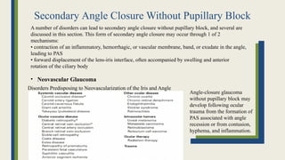 Secondary Angle Closure Without Pupillary Block
A number of disorders can lead to secondary angle closure without pupillary block, and several are
discussed in this section. This form of secondary angle closure may occur through 1 of 2
mechanisms:
• contraction of an inflammatory, hemorrhagic, or vascular membrane, band, or exudate in the angle,
leading to PAS
• forward displacement of the lens-iris interface, often accompanied by swelling and anterior
rotation of the ciliary body
• Neovascular Glaucoma
Disorders Predisposing to Neovascularization of the Iris and Angle
Angle-closure glaucoma
without pupillary block may
develop following ocular
trauma from the formation of
PAS associated with angle
recession or from contusion,
hyphema, and inflammation.
 