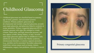 Childhood Glaucoma
• Childhood glaucomas are classified based on anatomy,
age of onset, genetics, and associated systemic
conditions. Primary pediatric glaucomas are
developmental and include congenital glaucoma, juvenile
open-angle glaucoma, and glaucoma linked to systemic or
ocular anomalies. Primary congenital glaucoma (PCG)
typically presents with signs like enlarged or cloudy
corneas, Haab striae, and high intraocular pressure, and
may appear at birth, during infancy, or later. Juvenile
open-angle glaucoma appears later in childhood or early
adulthood. Systemic diseases like Marfan syndrome,
chromosomal disorders, or anterior segment anomalies
(e.g., aniridia) can be associated. Secondary glaucomas
result from various causes such as trauma, tumors,
inflammation, surgery, lens problems, infection, or steroid
use.
Primary congenital glaucoma
 