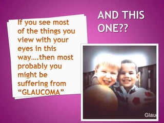 Glaucoma meducation part III