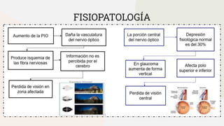 FISIOPATOLOGÍA
 