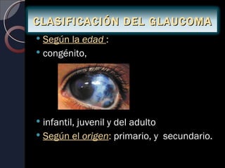CLASIFICACIÓN DEL GLAUCOMA
 Según la edad :
 congénito,




 infantil, juvenil y del adulto
 Según el origen: primario, y secundario.
 