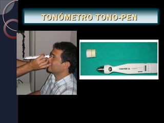TONÓMETRO TONO-PEN
 