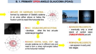 • ARCUATE OR BJERRUM’S SCOTOMA -
formed by extension of Seidel’s scotoma
in an area either above or below the
fixation point to reach thehorizontal line
• RING/ DOUBLEARCUATESCOTOMA
- develops when the two arcuate
scotomasjointogether
• ROENNE'S CENTRAL NASAL STEP - two
arcuate scotomas run in different arcs and
meet to form a sharp right-angled defect
at the horizontal meridian
• PERIPHERALFIELDDEFECTS
- canappear in early and
late stages
• ADVANCEDFIELDDEFECTS
- eventually only a small
island of central vision
(TUBULARVISION)areleft
B. 1. PRIMARY OPEN-ANGLE GLAUCOMA (POAG)
 