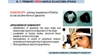 • GONIOSCOPY- primary importance in POAGis
to rule out other formsof glaucoma
GOLDMANN’SGONIOLENS&TECHNIQUEOFGONIOSCOPY
• APPLICATIONSOFGONIOSCOPY:
1. Classification of glaucoma into open angle and
closedangle based onconfiguration of the angle
2. Localization of foreign bodies, abnormal blood
vesselsor tumorsin theangle.
3. Demonstration of extent of peripheral anterior
synechiaeand henceplanning of glaucomasurgery
4. Direct goniolensisusedduringgoniotomy
B. 1. PRIMARY OPEN-ANGLE GLAUCOMA (POAG)
 